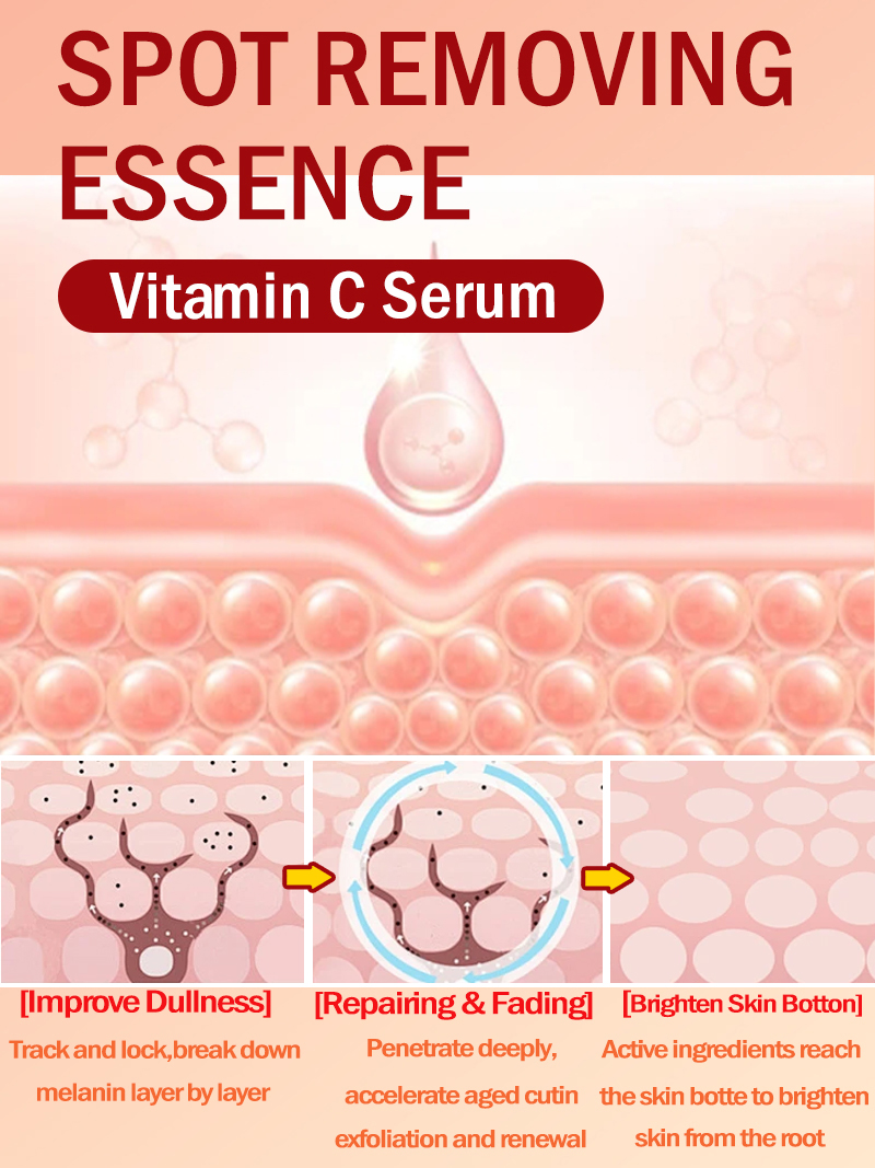 Lighten Freckles Melasma, Faci - огляд і ціна Luxury Natural Skincare